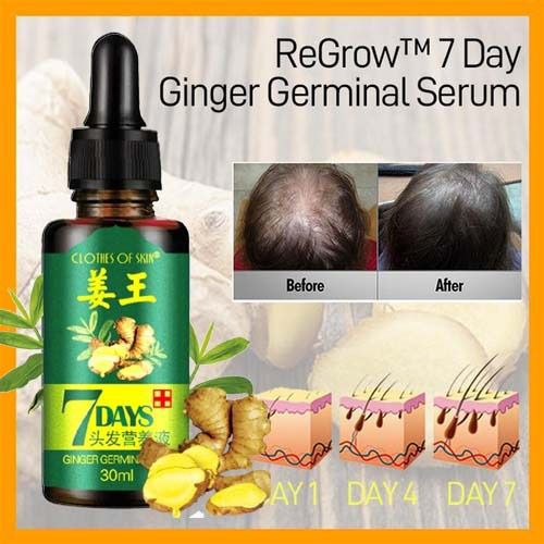 ๐ฟ 7 Day Ginger Germinal Oil | Hair Growth Essence & Hair Care Solution